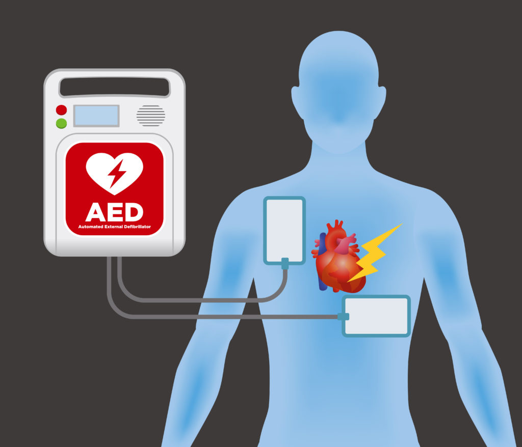 automated external defibrillator